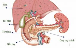 Sỏi tụy có nguy hiểm không? Nguyên nhân và cách điều trị