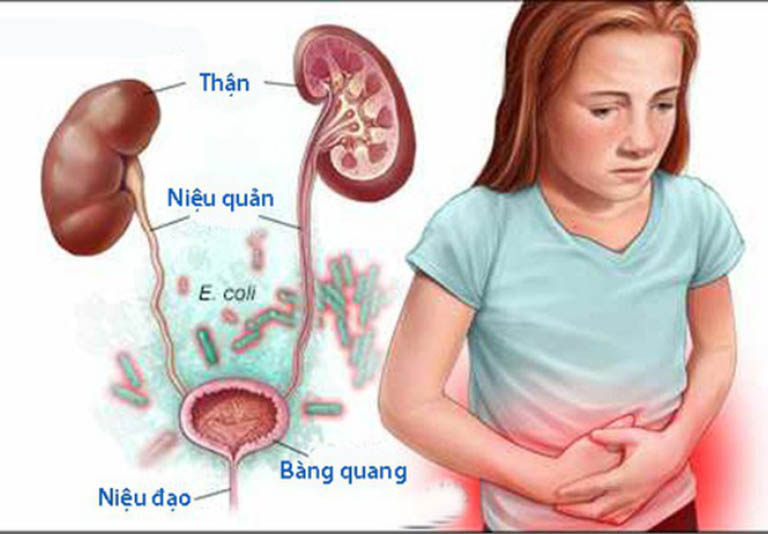 Tiểu buốt, tiểu khó liên quan đến bệnh viêm đường tiết niệu