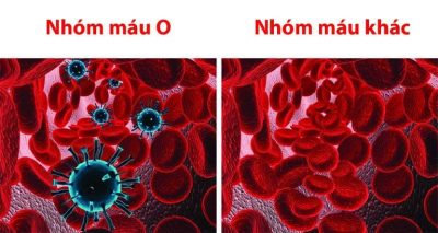 Cách Nhận Biết Nhóm Máu O Nhanh Chóng, Chính Xác Và Cực Đơn Giản