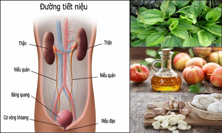 Cách chữa viêm đường tiết niệu nữ: Phương pháp hiệu quả và an toàn