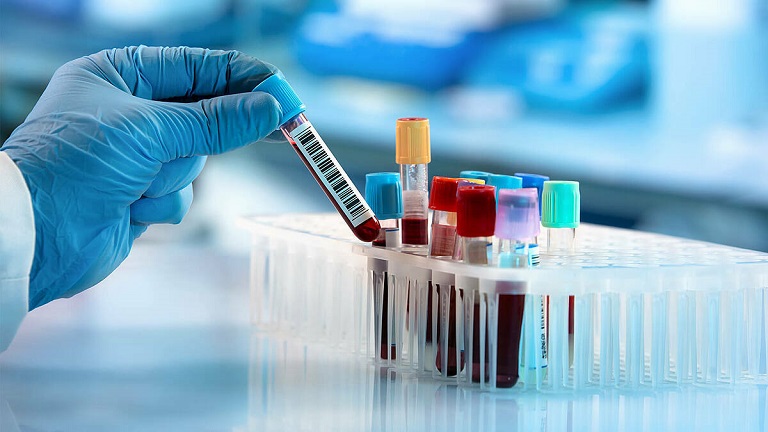 Xét nghiệm nhóm máu là cách chính xác nhất giúp bạn nhận biết nhóm máu của mình