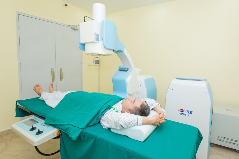 Tán sỏi ngoài cơ thể bằng tia laser