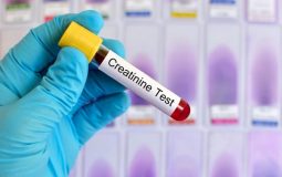 Xét nghiệm creatinin giúp chẩn đoán các vấn đề liên quan đến thận