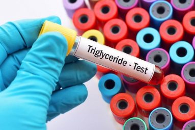 Xét Nghiệm Triglycerid Là Gì? Những Lưu Ý Quan Trọng Khi Thực Hiện