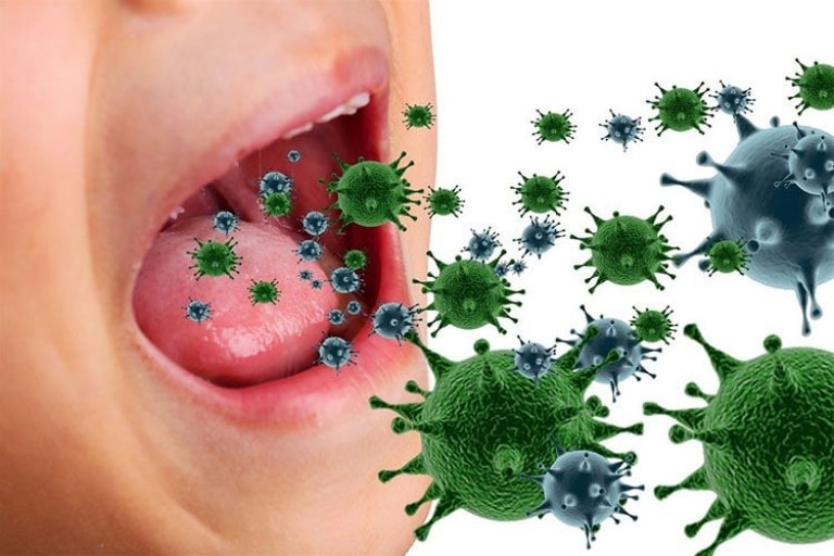 Virus, vi khuẩn là những tác nhân chủ yếu gây viêm họng 