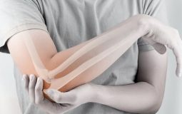 3 biện pháp điều trị đau khớp khuỷu tay hiệu quả, an toàn nhất
