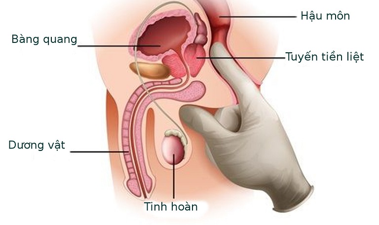 Khoảng 70% tuyến tiền liệt được cấu tạo từ mô tuyến