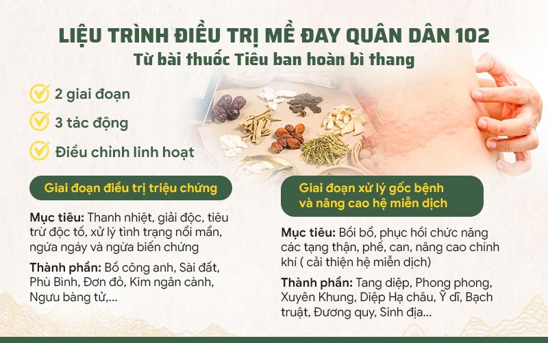 Phác đồ xử lý mề đay được chia nhỏ làm 2 giai đoạn tại Quân dân 102