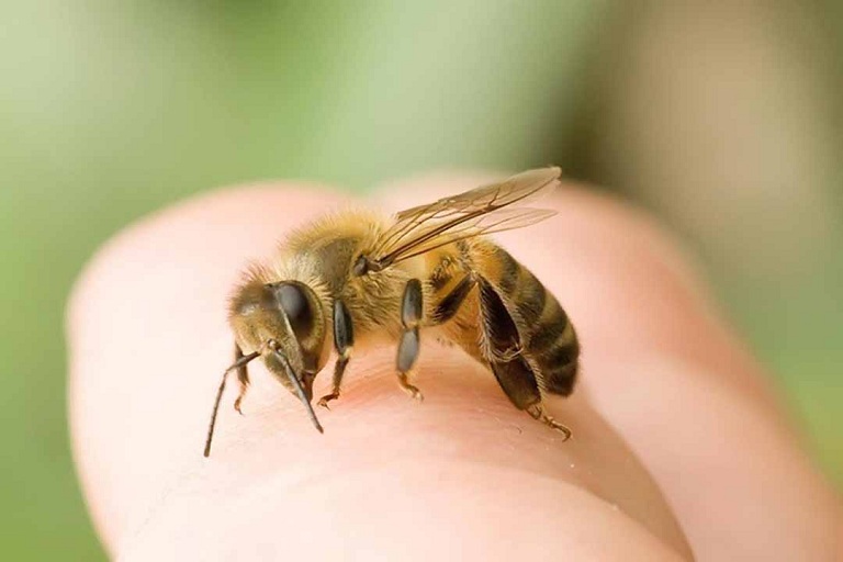 Khi bị ngứa kẽ ngón tay do ong cắn, người bệnh cần phải gặp bác sĩ để xử lý