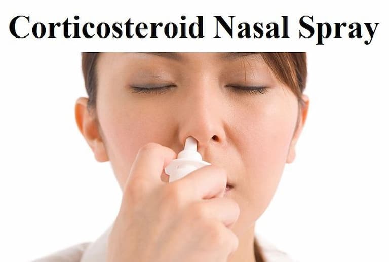 Corticosteroid cũng được sử dụng trong đơn thuốc chữa viêm xoang cấp tính