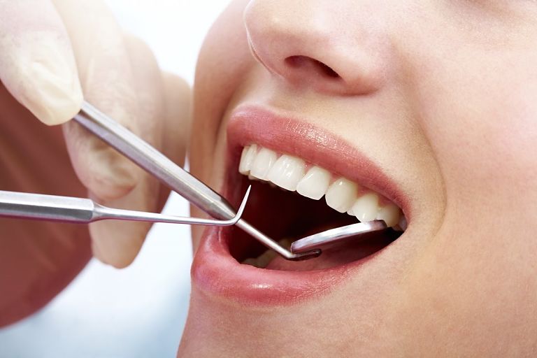 Khách hàng sẽ được kiểm tra răng miệng và lấy dấu răng trước khi niềng răng