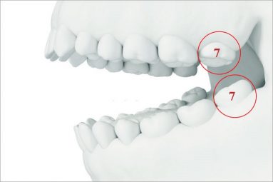Răng số 7 có vị trí nằm ở phía trong cùng của cung hàm