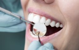 Bọc răng sứ cho răng lộn xộn giá bao nhiêu phụ thuộc vào nhiều yếu tố