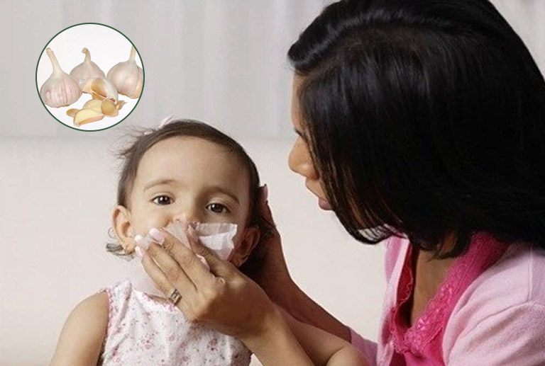 Dùng nước cốt tỏi nhỏ trực tiếp vào mũi trẻ có thể gây bỏng niêm mạc mũi