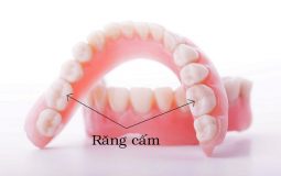 Răng cấm là răng hàm nằm tại vị trí số 6 trên cung hàm