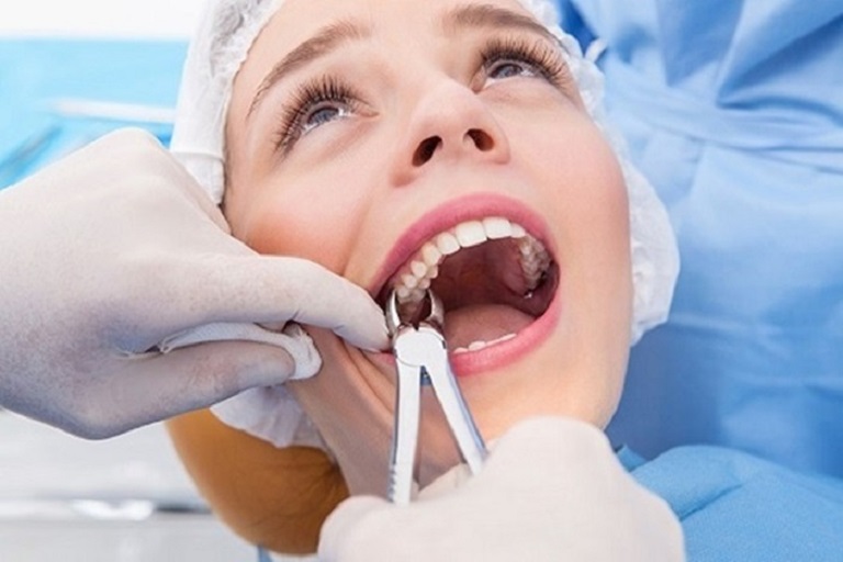Nhiều trường hợp mất răng nghiêm trọng sẽ ảnh hưởng lớn tới chân răng