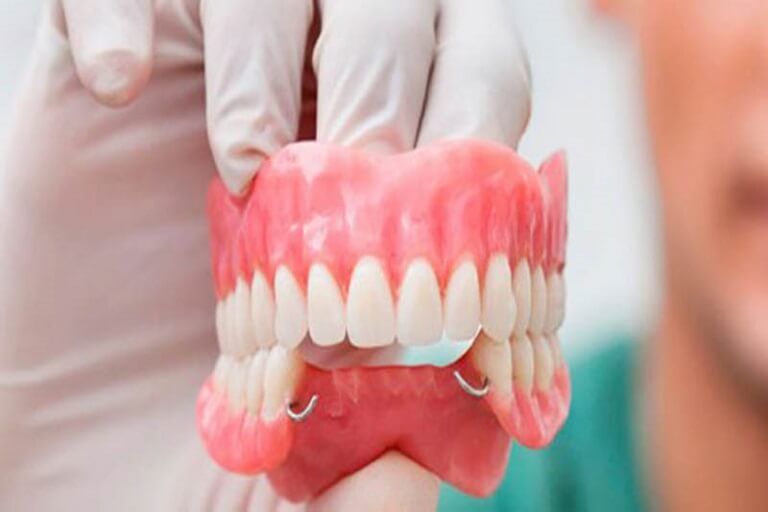 Trồng răng giả tháo lắp là phương pháp giúp phục hình răng bị mất mà nhiều người lựa chọn