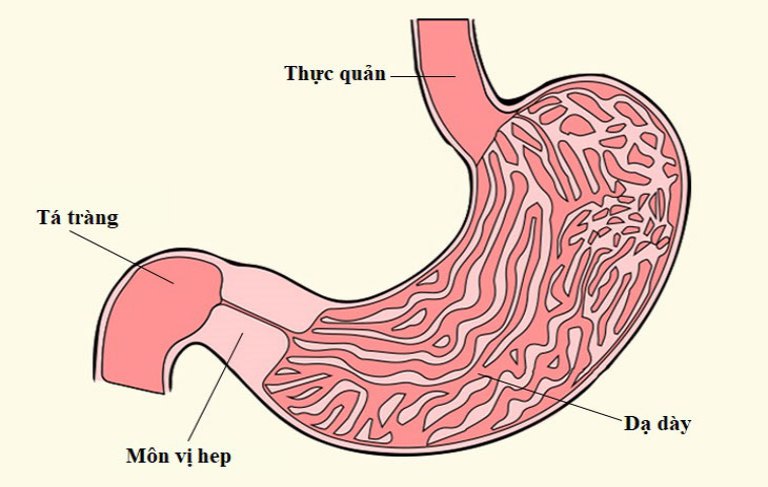 Hẹp môn vị do bệnh dạ dày khiến cho quá trình vận chuyển thức ăn gặp nhiều khó khăn