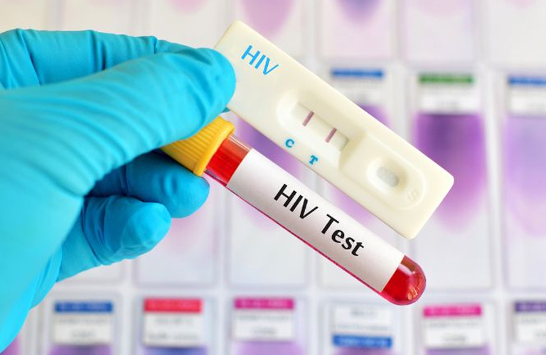 Chẩn đoán nổi mề đay do HIV cần được thực hiện sớm