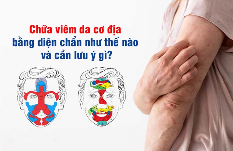 Chữa viêm da cơ địa bằng diện chẩn tác động lên huyệt vị để kích thích máu lưu thông