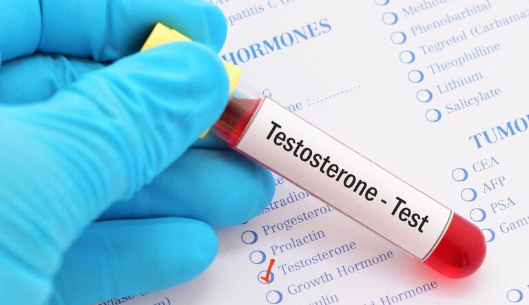 Nam giới cần xét nghiệm để biết bệnh lý liên quan đến hormone testoterone