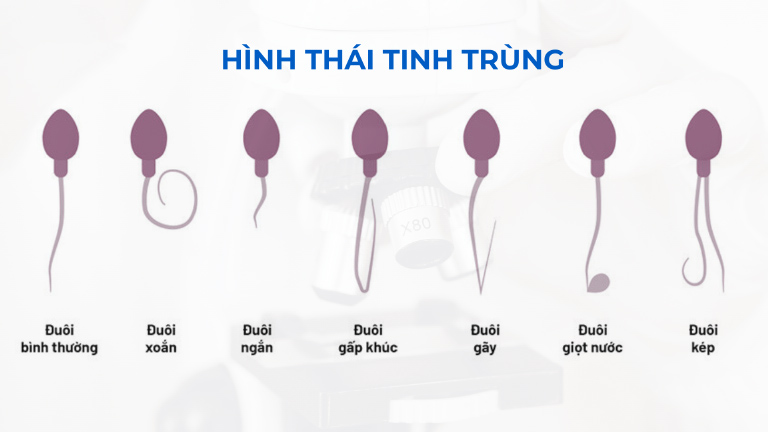 Hình dạng của tình trùng