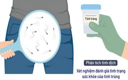 Vô Sinh Nam: Những Sai Lầm Phổ Biến Khi Điều Trị