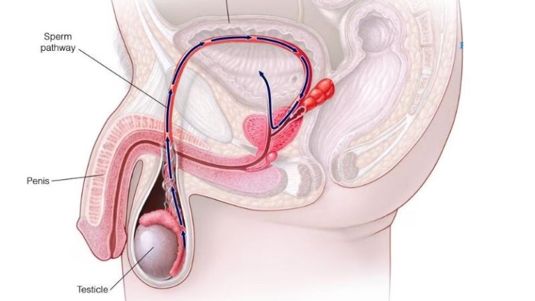 Xuất tinh ngược dòng hay còn gọi là cực khoái khô