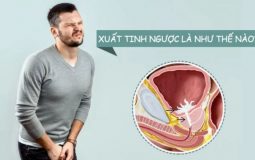 Xuất Tinh Ngược Dòng: Dấu Hiệu, Chẩn Đoán Và Cách Điều Trị